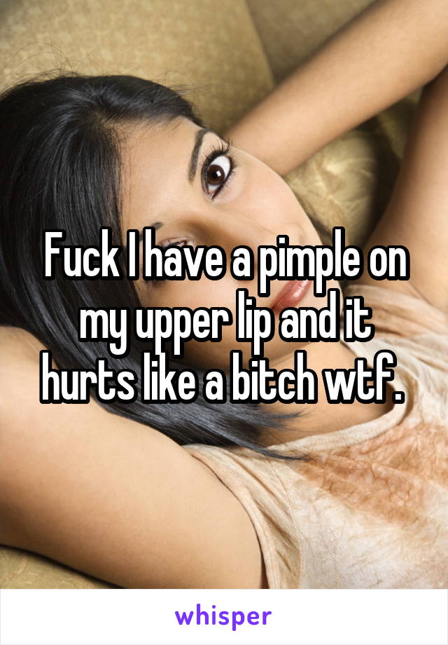 Fuck I have a pimple on my upper lip and it hurts like a bitch wtf. 