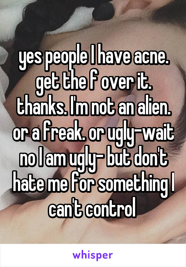 yes people I have acne. get the f over it. thanks. I'm not an alien. or a freak. or ugly-wait no I am ugly- but don't hate me for something I can't control 