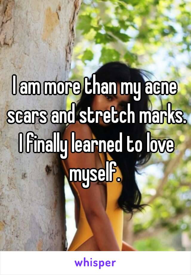 I am more than my acne scars and stretch marks. I finally learned to love myself. 