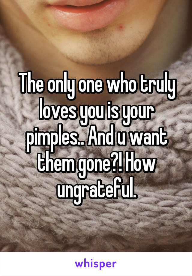 The only one who truly loves you is your pimples.. And u want them gone?! How ungrateful.