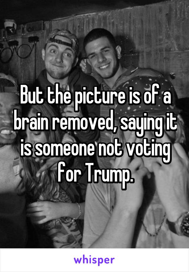 But the picture is of a brain removed, saying it is someone not voting for Trump.