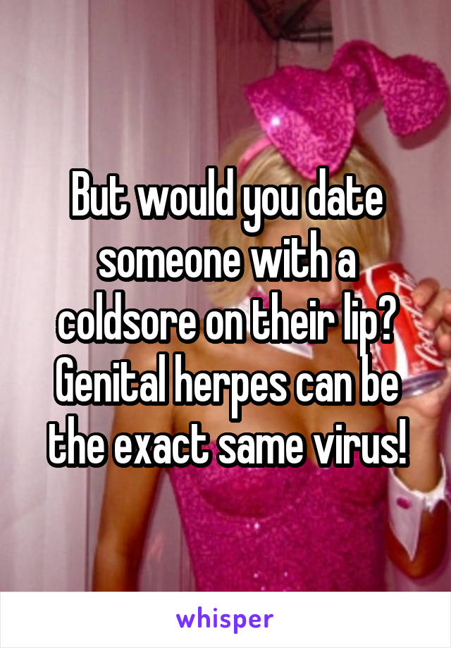 But would you date someone with a coldsore on their lip? Genital herpes can be the exact same virus!