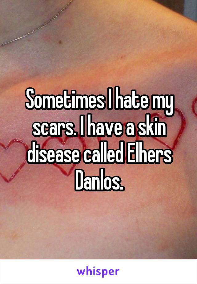 Sometimes I hate my scars. I have a skin disease called Elhers Danlos.