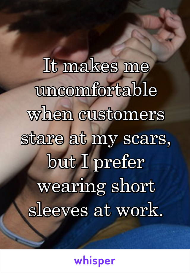 It makes me uncomfortable when customers stare at my scars, but I prefer wearing short sleeves at work.