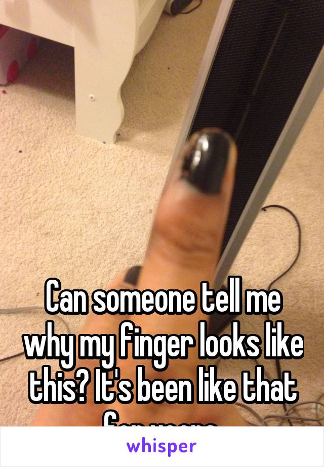 





Can someone tell me why my finger looks like this? It's been like that for years 