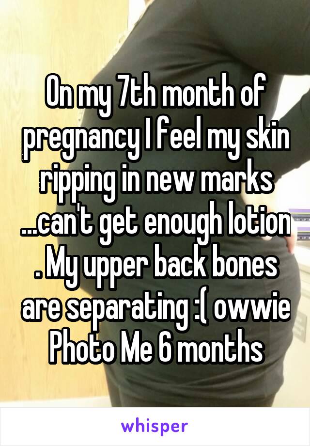On my 7th month of pregnancy I feel my skin ripping in new marks ...can't get enough lotion . My upper back bones are separating :( owwie
Photo Me 6 months