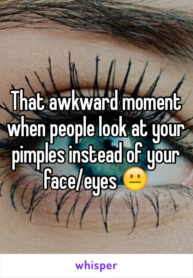 That awkward moment when people look at your pimples instead of your face/eyes 😐