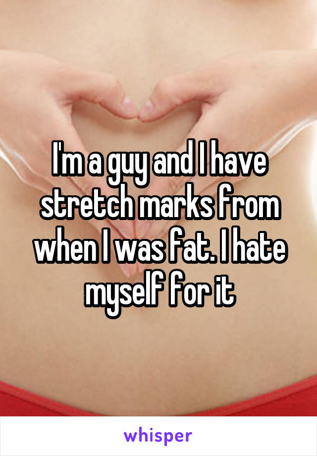 I'm a guy and I have stretch marks from when I was fat. I hate myself for it