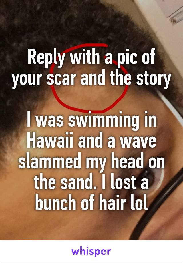 Reply with a pic of your scar and the story

I was swimming in Hawaii and a wave slammed my head on the sand. I lost a bunch of hair lol