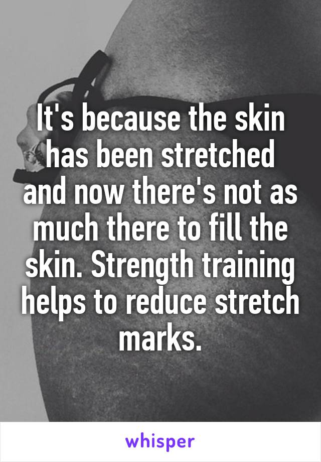 It's because the skin has been stretched and now there's not as much there to fill the skin. Strength training helps to reduce stretch marks.
