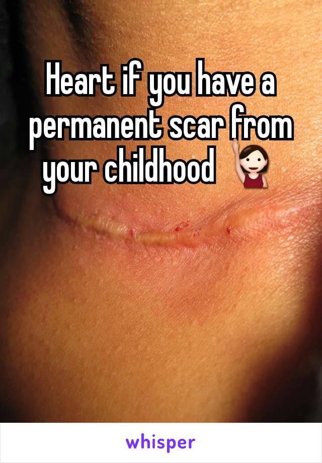 Heart if you have a permanent scar from your childhood 🙋