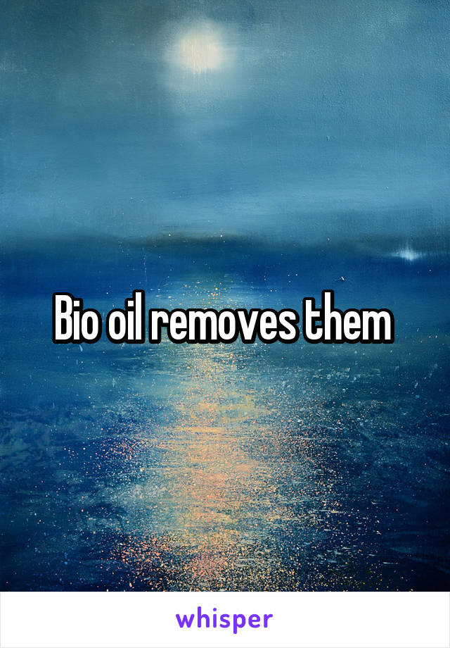 Bio oil removes them 
