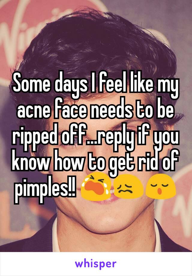 Some days I feel like my acne face needs to be ripped off...reply if you know how to get rid of pimples!! 😭😖😌