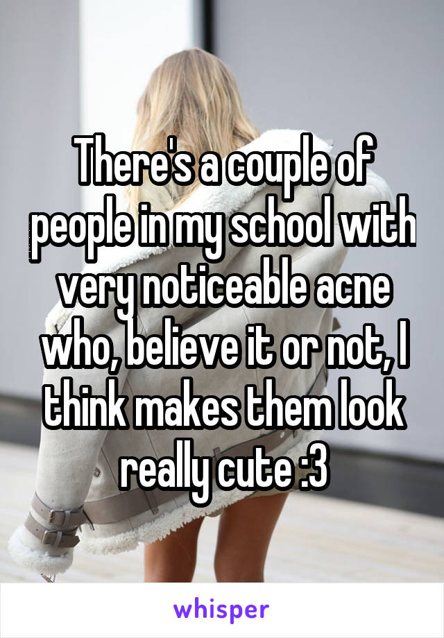 There's a couple of people in my school with very noticeable acne who, believe it or not, I think makes them look really cute :3