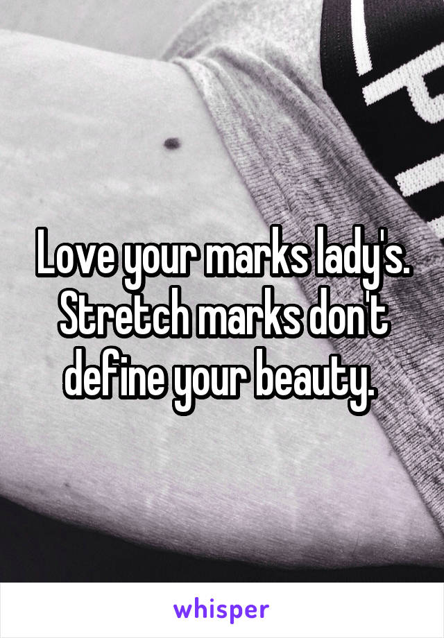Love your marks lady's. Stretch marks don't define your beauty. 
