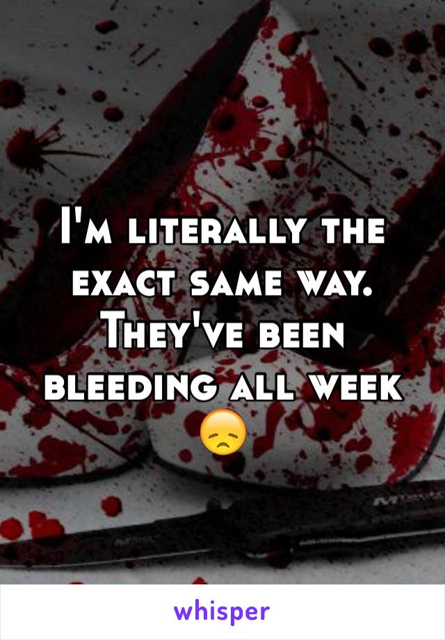 I'm literally the exact same way. They've been bleeding all week 😞