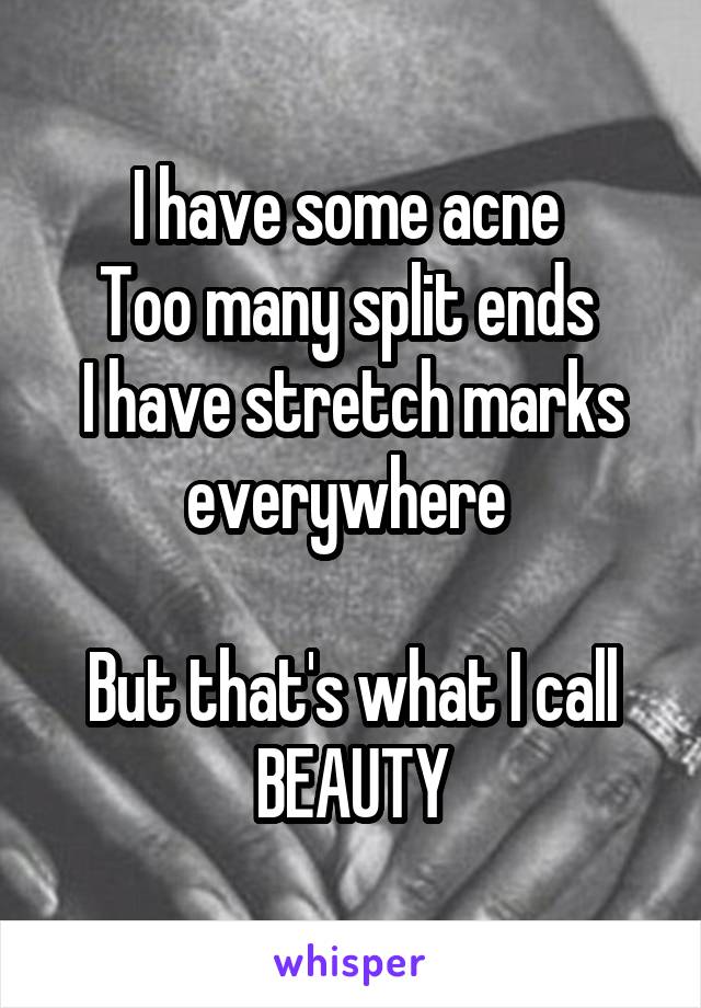 I have some acne 
Too many split ends 
I have stretch marks everywhere 

But that's what I call BEAUTY