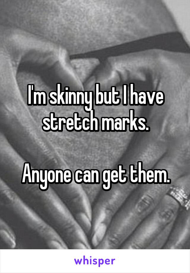 I'm skinny but I have stretch marks.

Anyone can get them.