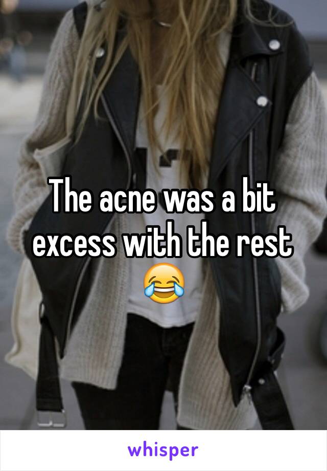 The acne was a bit excess with the rest
😂