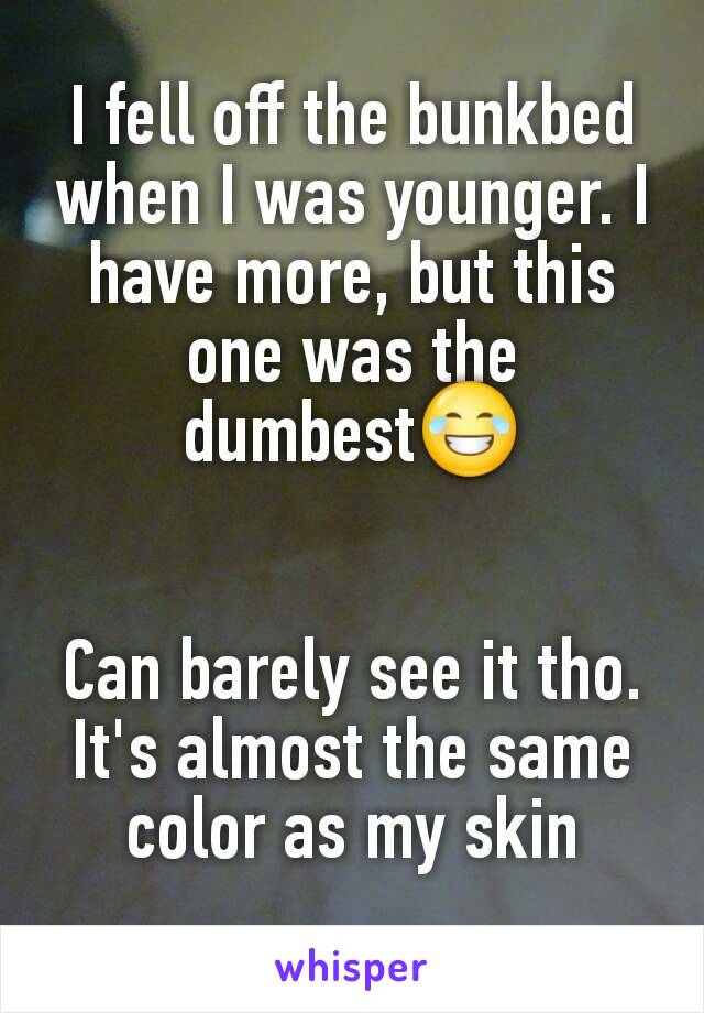 I fell off the bunkbed when I was younger. I have more, but this one was the dumbest😂


Can barely see it tho. It's almost the same color as my skin