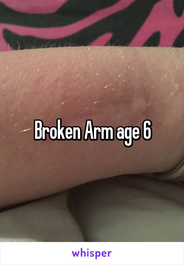 Broken Arm age 6