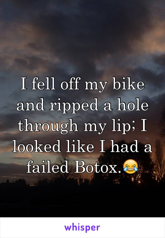 I fell off my bike and ripped a hole through my lip; I looked like I had a failed Botox.😂