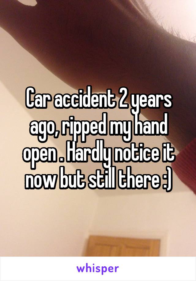 Car accident 2 years ago, ripped my hand open . Hardly notice it now but still there :)