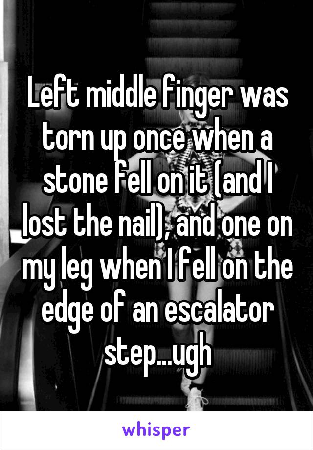 Left middle finger was torn up once when a stone fell on it (and I lost the nail), and one on my leg when I fell on the edge of an escalator step...ugh