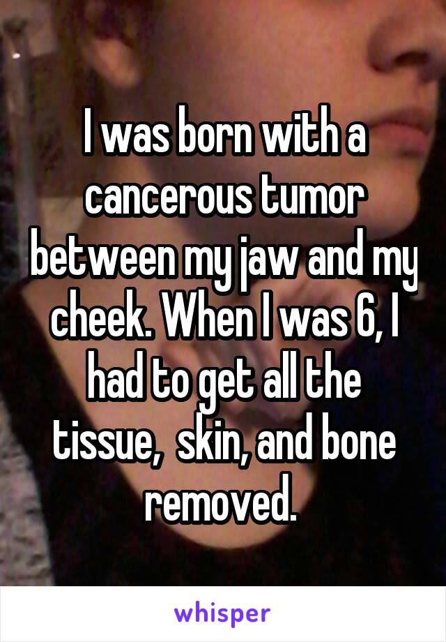 I was born with a cancerous tumor between my jaw and my cheek. When I was 6, I had to get all the tissue,  skin, and bone removed. 