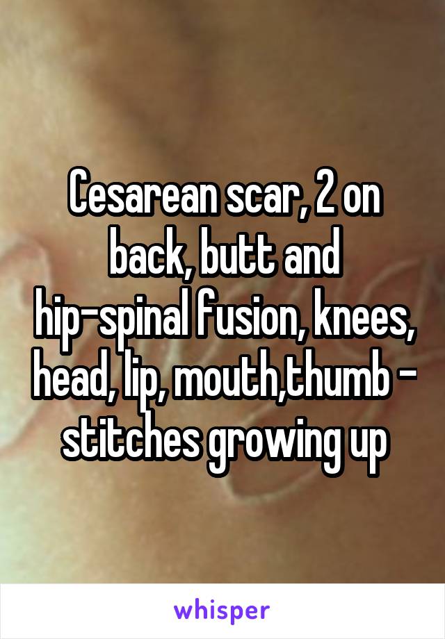 Cesarean scar, 2 on back, butt and hip-spinal fusion, knees, head, lip, mouth,thumb - stitches growing up