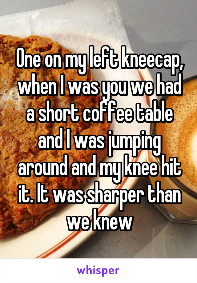 One on my left kneecap, when I was you we had a short coffee table and I was jumping around and my knee hit it. It was sharper than we knew