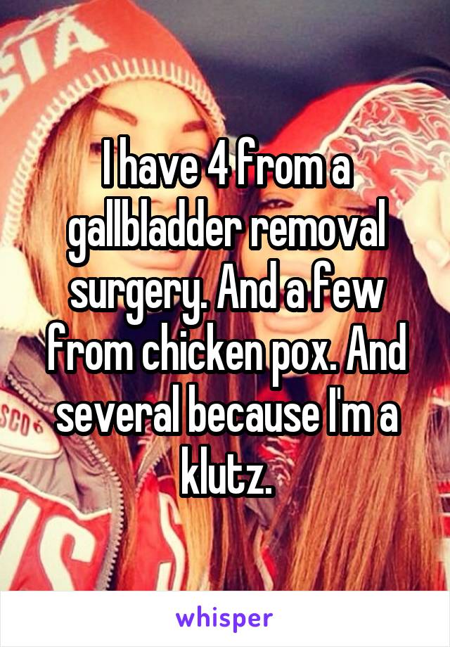 I have 4 from a gallbladder removal surgery. And a few from chicken pox. And several because I'm a klutz.