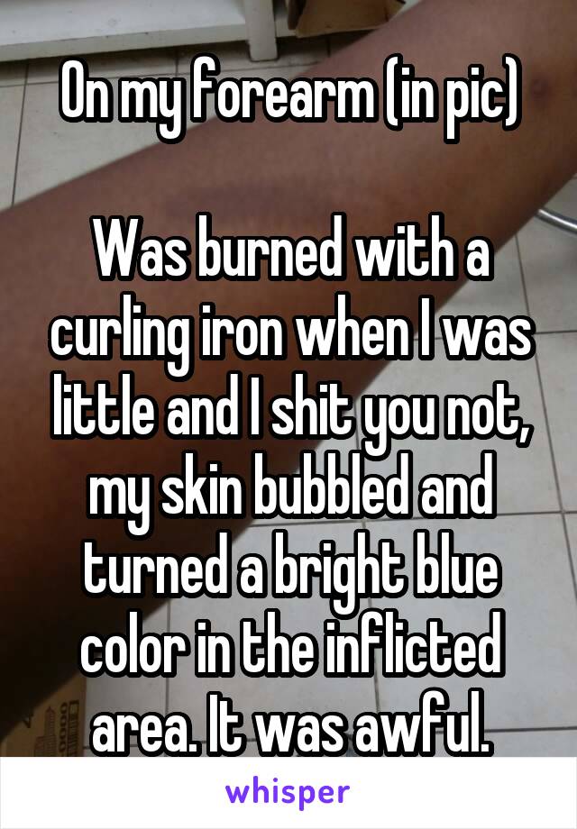 On my forearm (in pic)

Was burned with a curling iron when I was little and I shit you not, my skin bubbled and turned a bright blue color in the inflicted area. It was awful.