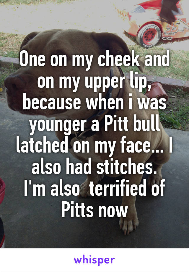 One on my cheek and on my upper lip, because when i was younger a Pitt bull latched on my face... I also had stitches.
I'm also  terrified of Pitts now