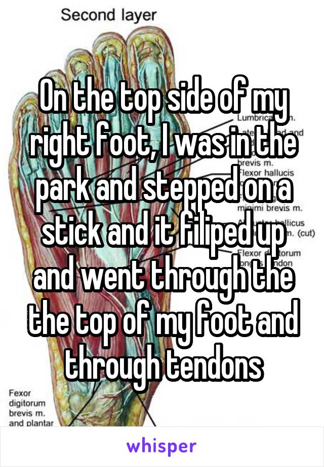 On the top side of my right foot, I was in the park and stepped on a stick and it filiped up and went through the the top of my foot and through tendons