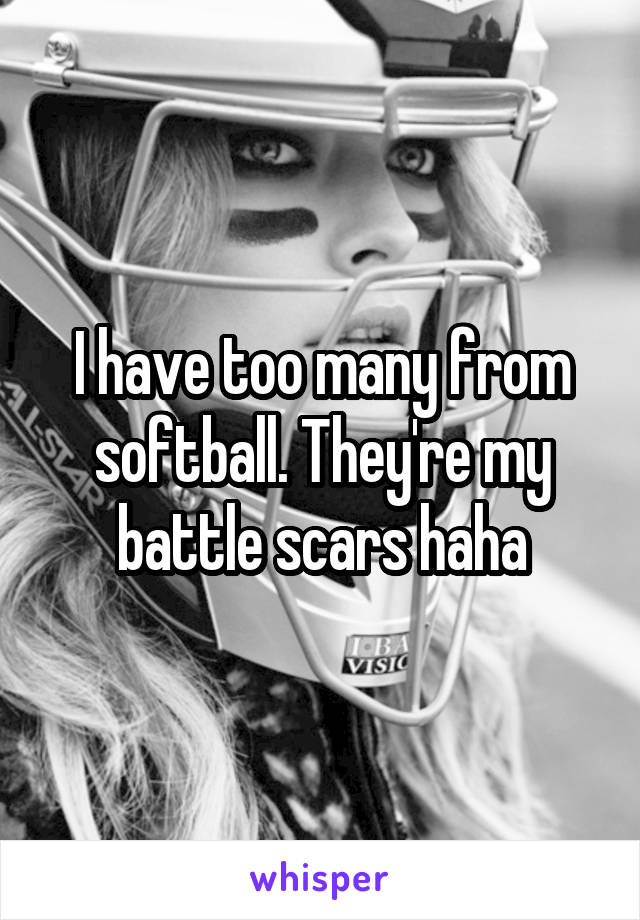 I have too many from softball. They're my battle scars haha