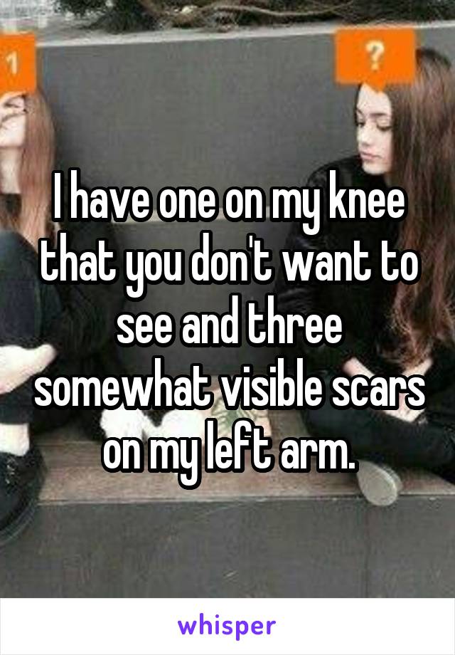 I have one on my knee that you don't want to see and three somewhat visible scars on my left arm.