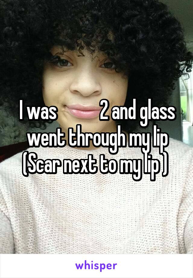 I was            2 and glass went through my lip
(Scar next to my lip ) 