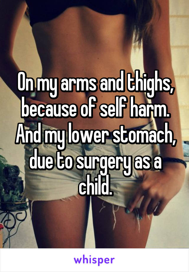 On my arms and thighs, because of self harm. And my lower stomach, due to surgery as a child.