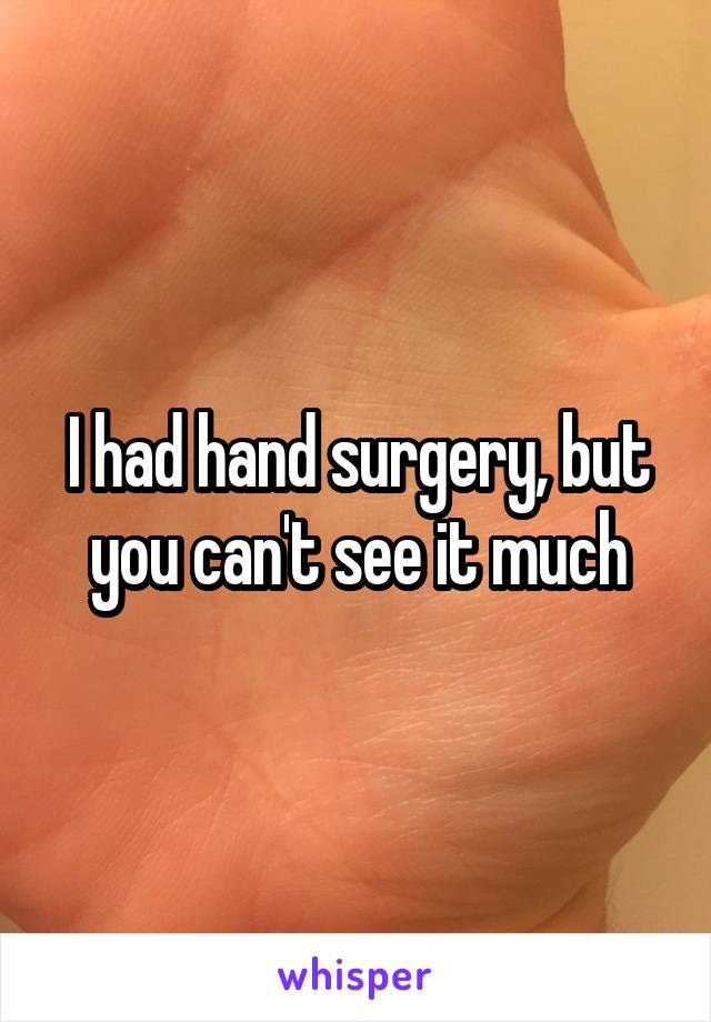 I had hand surgery, but you can't see it much