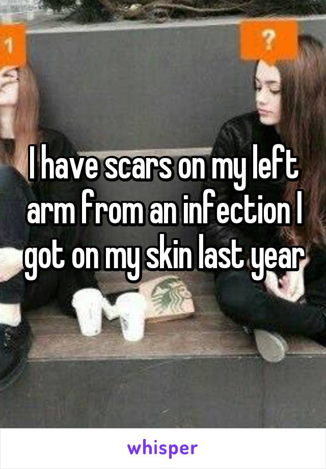 I have scars on my left arm from an infection I got on my skin last year 