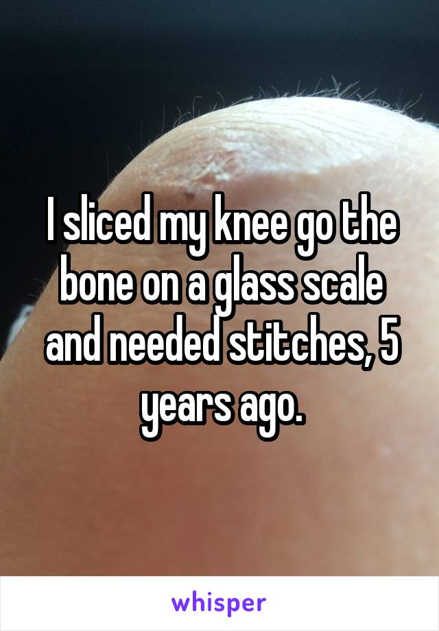 I sliced my knee go the bone on a glass scale and needed stitches, 5 years ago.