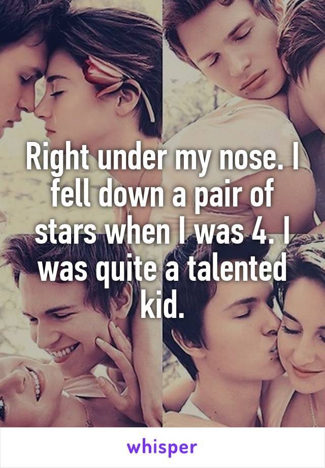 Right under my nose. I fell down a pair of stars when I was 4. I was quite a talented kid.