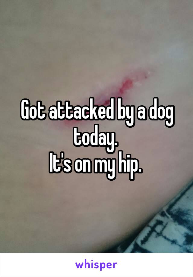 Got attacked by a dog today. 
It's on my hip. 