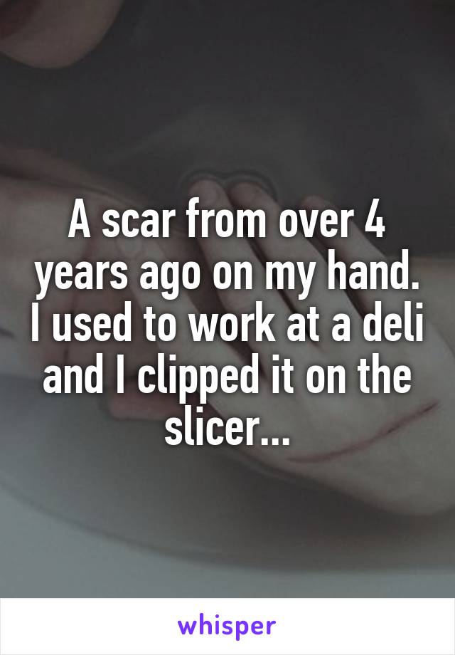 A scar from over 4 years ago on my hand. I used to work at a deli and I clipped it on the slicer...