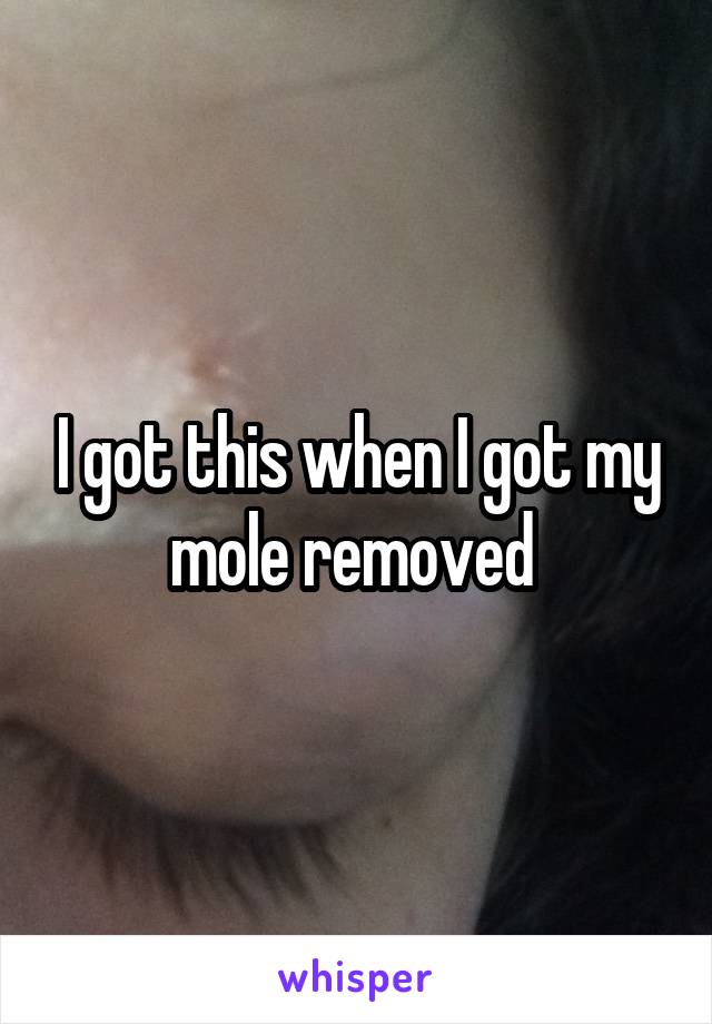 I got this when I got my mole removed 