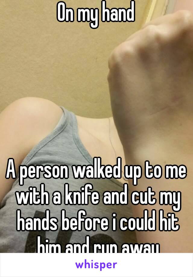 On my hand





A person walked up to me with a knife and cut my hands before i could hit him and run away