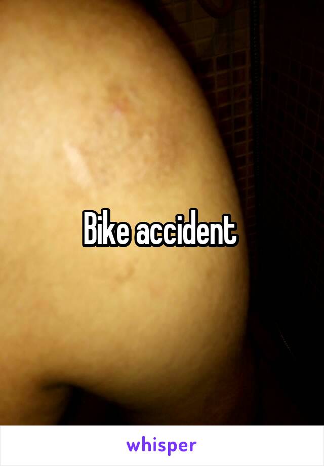 Bike accident 