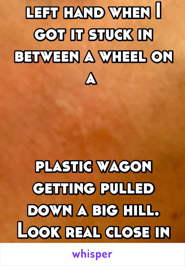 I have a scar on my left hand when I got it stuck in between a wheel on a 



plastic wagon getting pulled down a big hill. Look real close in the middle of this picture.