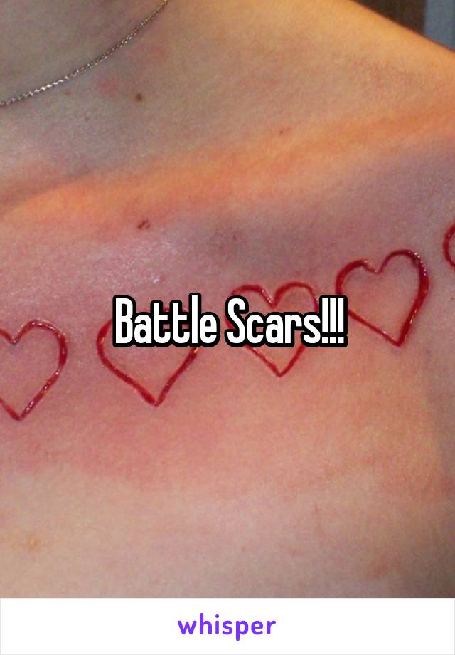 Battle Scars!!!